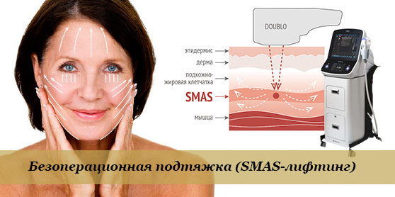 Действие SMAS-лифтинга