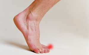 Симптоматика врастания ногтей на ногах