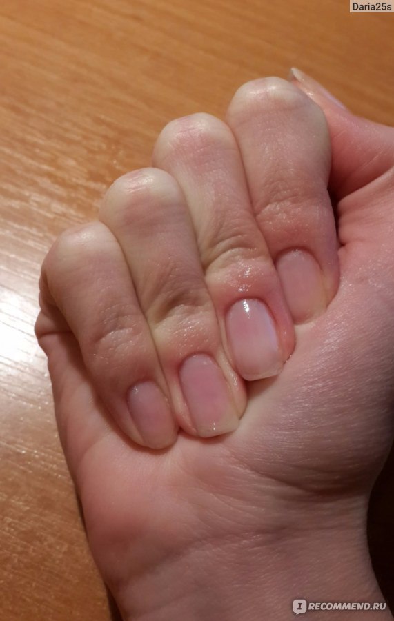Ногти после геля стали тонкие. Ногти после снятия гел. Ногти после химиотерапии. Результат восстановления ногтей.