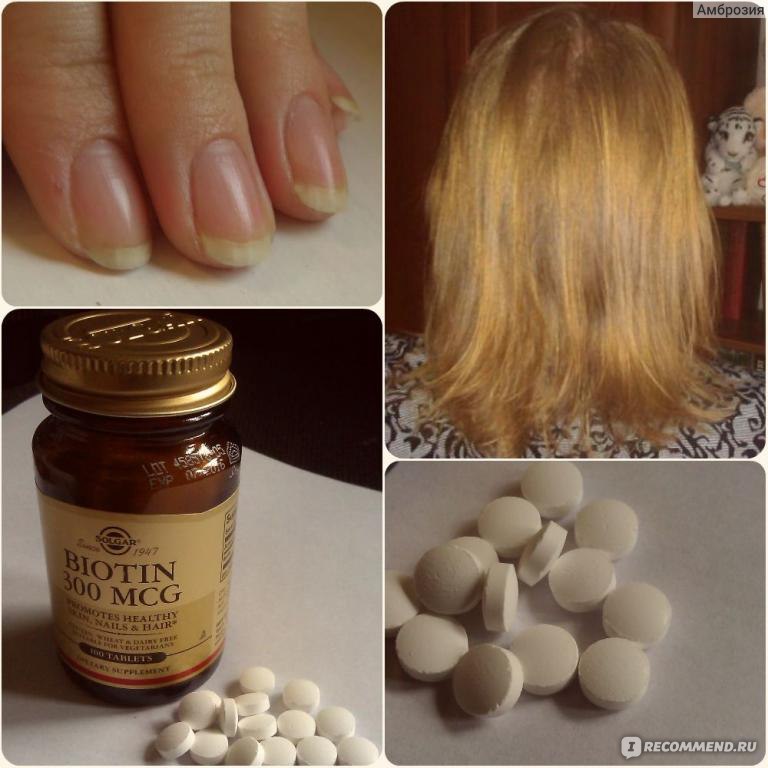 Какие витамины пить для волос и кожи. Витамины для роста волос биотин. Биотин Солгар витамины для волос. Биотин витамины для ногтей. Витамины кожа волосы ногти.