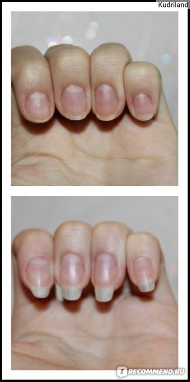 Медленно растут ногти. Ногти за месяц. Ногти до и после отращивания. Ногти отрасли за месяц. Отрастить ногти.