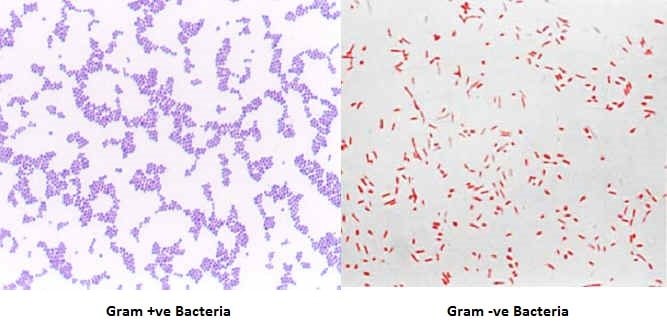 Gram Staining Interpretation