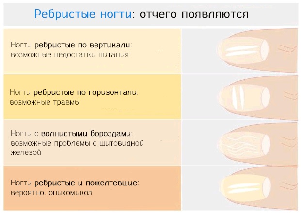 Ногти ребристые: почему, причины и что делать