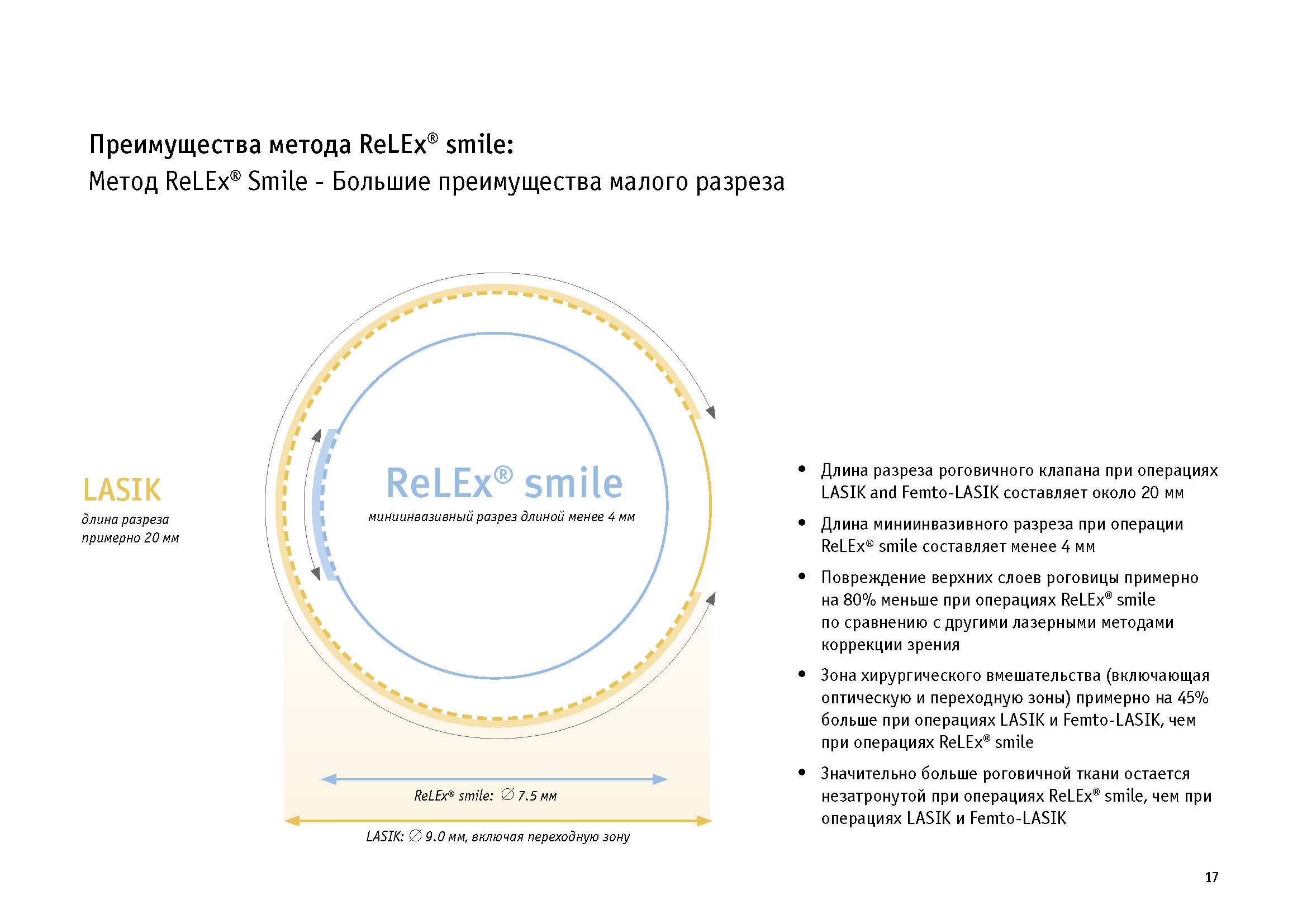 Коррекция зрения методом смайл. RELEX smile лазерная коррекция зрения. Технология smile коррекция зрения. Метод RELEX smile. Лазерная коррекция методом smile.