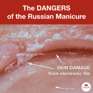 Russian Manicure Damage Microscopic Photos